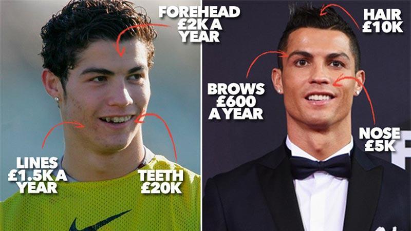 جراحة تجميلية كريستيانو رونالدو أسرار وجه كريستيانو - جراحة تجميلية كريستيانو رونالدو