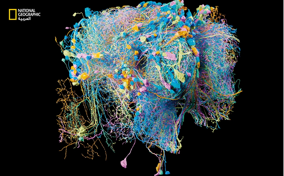 خرائط دماغية جديدة قد تغير مواجهة الزهايمر والتصلب المتعدد - خرائط دماغية جديدة
