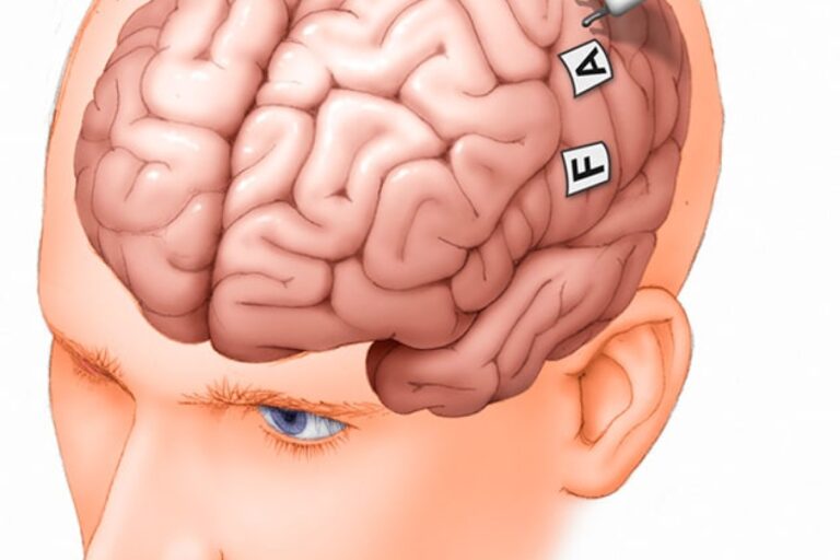 خرائط دماغية جديدة قد تغير مواجهة الزهايمر والتصلب المتعدد