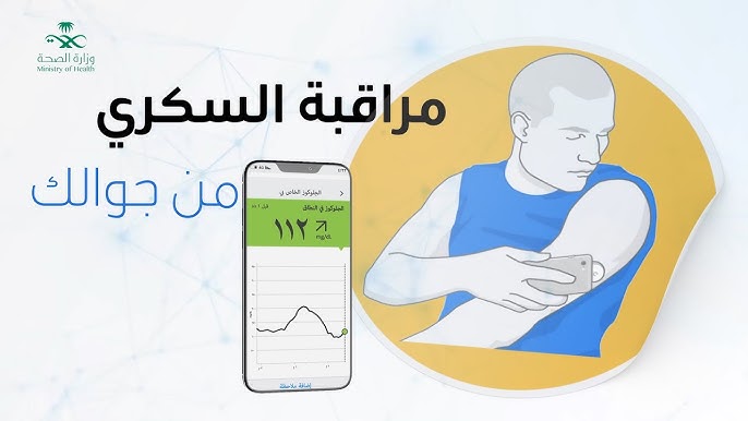 ثلاثة أشياء مفاجئة تعلمتها من استخدام جهاز مراقبة السكر - مراقبة السكر