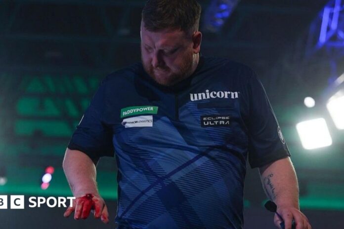 كاميرون مينزيس اعتذار كاميرون مينزيس يعتذر عن ضرب الطاولة