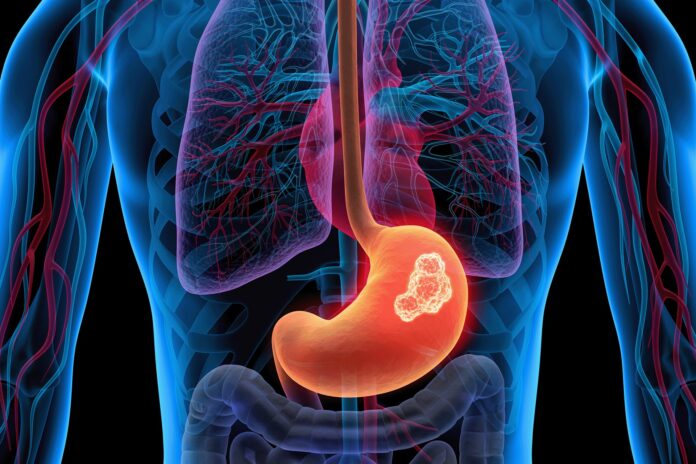 GettyImages-1168181201-1769187819